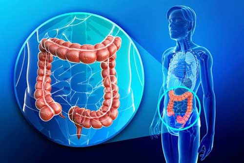 Colorectal tumors exacerbated by mouth microbes