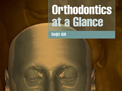 Orthodontics at a Glance, Ebook