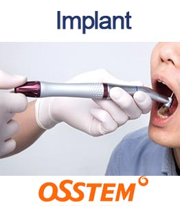 کاتالوگ Implant | Imolant