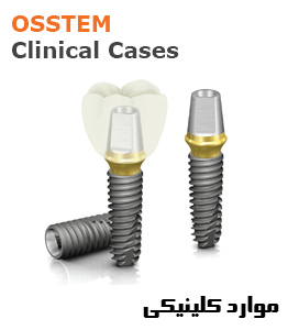 موارد کلینیکی ایمپلنت آستم | Clinical Cases