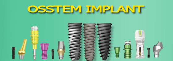 ایمپلنت،implant