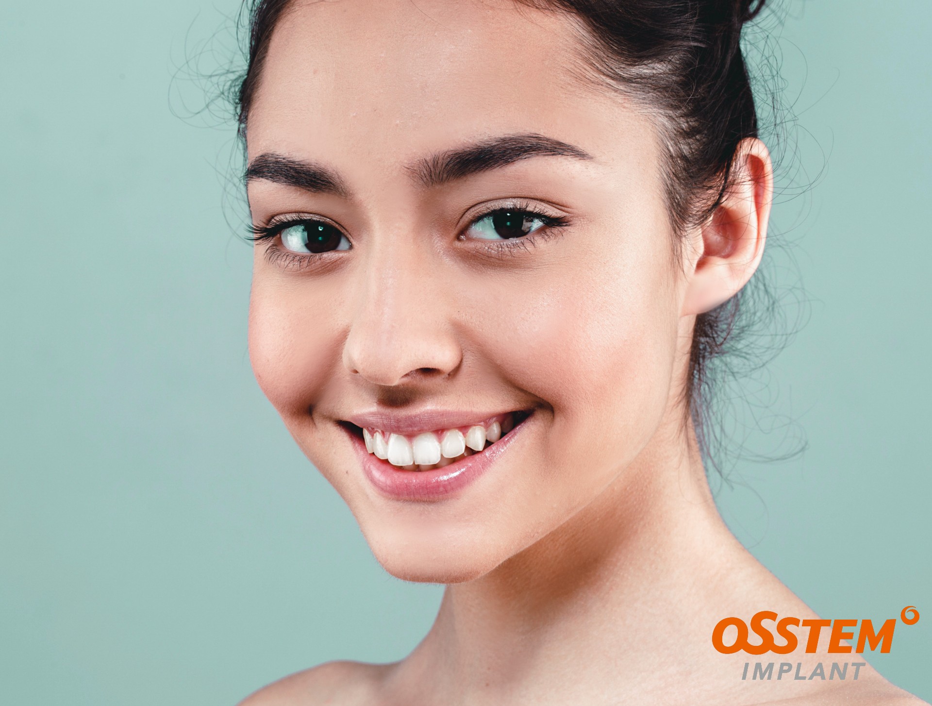 ایمپلنت،آستم،اوستم،implant,osstem