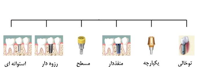 طبقه بندی ایمپلنت دندانی
