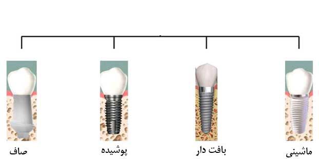 طبقه بندی ایمپلنت دندانی