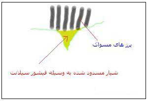 فیشور سیلنت