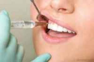 دندان عقل ، جراحی دندان عقل ، دندانپزشک ، پوسیدگی دندان عقل