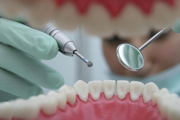 First data on new dental fillings that will repair tooth decay