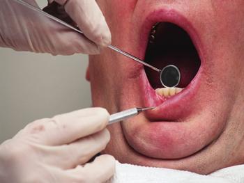 Unused dental surgery prescriptions may help fuel opioid epidemic