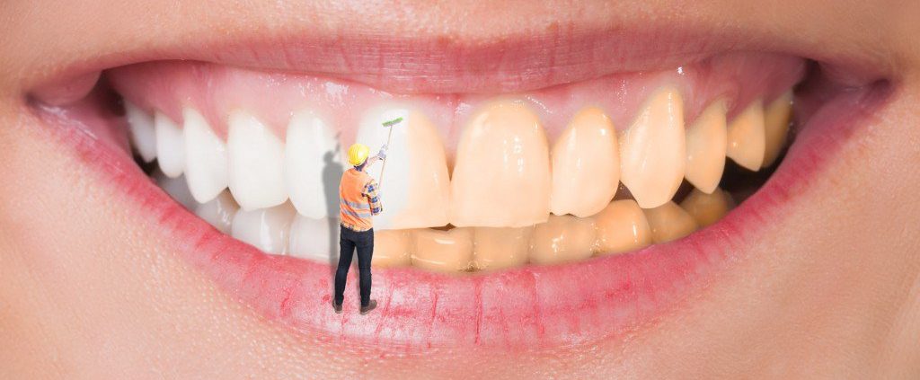 ارتودنسی،زرد شدن دندان،سفید کردن دندان ها،مینای دندان،عاج دندان