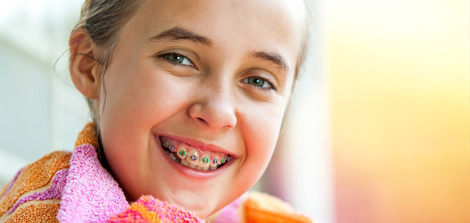 ارتودنسی،اوربایت