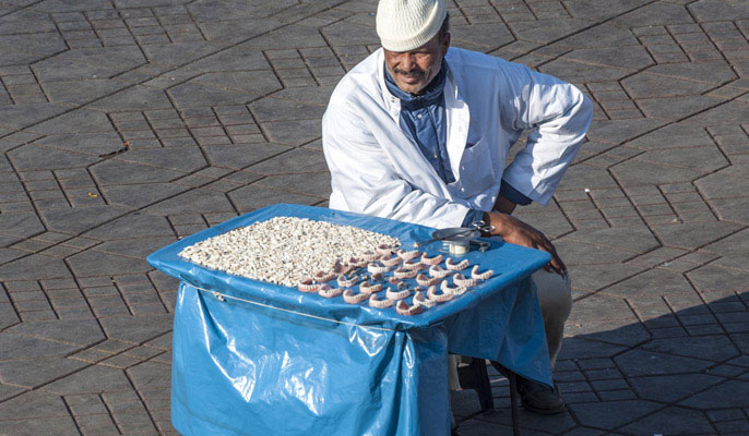 دندان،دندانپزشکی،آمالگام