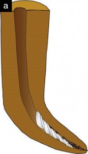 فایل روتاری،اندودنتیک