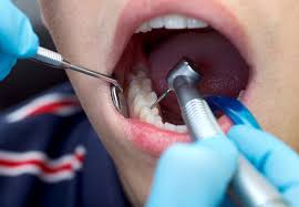 روت کانال،مواد دندانپزشکی،تجهیزات دندانپزشکی