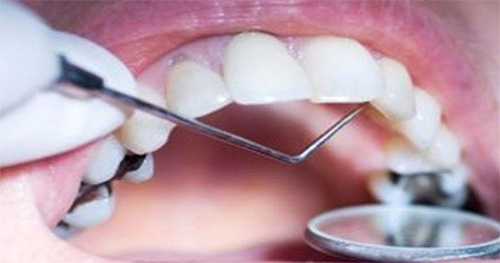 تجهیزات دندانپزشکی،دندانپزشکی