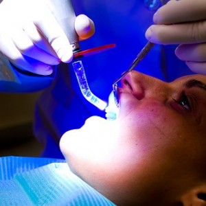 تجهیزات دندانپزشکی،لایت کیور،اشعه آبی،کامپوزیت