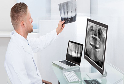 تصویر فیلم‎های رادیولوژی دندانپزشکی