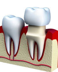 ترمیمی Operative