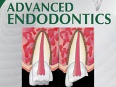 Advanced Endodontics, Ebook