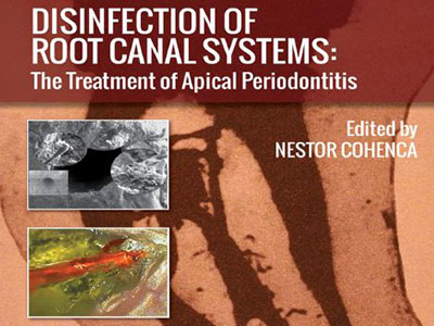 Disinfection of Root Canal , Ebook