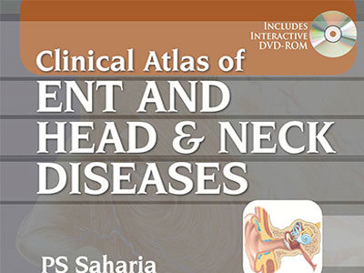 Clinical Atlas of ENT and Head & Neck Diseases, Ebook