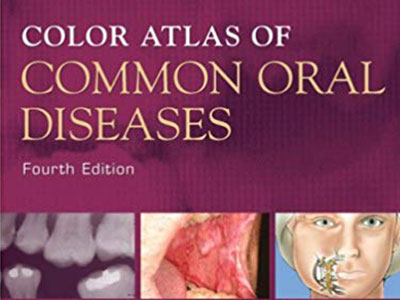 Color Atlas of Common Oral Diseases, Ebook