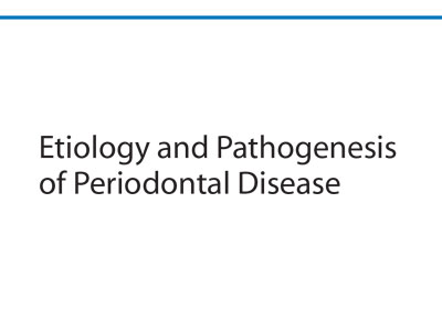 Etiology and Pathogenesis of Periodontal Disease, Ebook