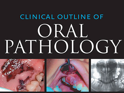 Clinical Outline of Oral Pathology, Ebook