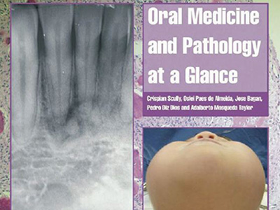 Oral Medicine and Pathology at a Glance, Ebook