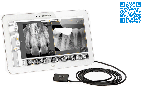 سنسور رادیوگرافی داخل دهانی -سایز بزرگ,RIOSensor_Size:42*30mm,Ray,ری,دندانپزشکی